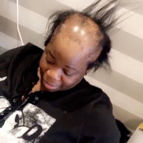 A woman with alopecia went to a salon in Brooklyn, New York, to get her hair done and left with the most amazing makeover. See it here! Alopecia Hair Growth, Alopecia Hairstyles, Pattern Baldness, Make Up Videos, Extreme Hair, Mega Hair, Bald Women, Lost Hair, Hair Regrowth