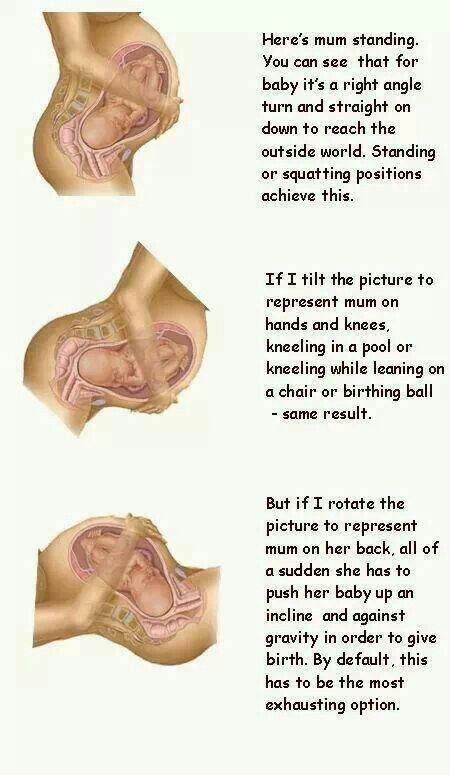 Impact of different positions during labor on child birth. I did position #3 with my first child in a hospital, it was terrible :/ with my 2nd I was on my hands and knees, 3rd I used a birthing stool, and with the current 4th I squatted with each push... Pushing was easier and faster! Gravity helps, naturally. Normal Birth, Pregnancy Labor, Baby Life Hacks, Childbirth Education, Natural Pregnancy, Birth Labor, Birth Plan, Baby Advice, Baby Prep