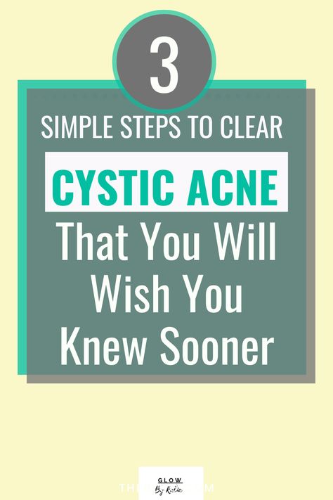 How To Remove Cystic Acne, Foods For Cystic Acne, Skin Care Routine For Cystic Acne, Acne Elimination Diet, Heal Pimples Fast, How To Get Rid Of Cystic Acne Overnight, Natural Remedies For Cystic Acne, Get Rid Of Cystic Acne Overnight, Cystic Acne Skin Care Routine