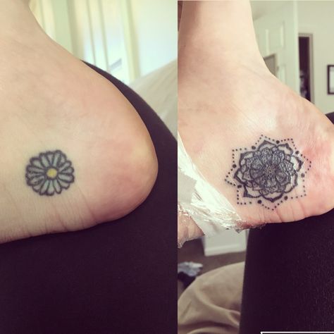 Mandala cover up tattoo Ladies Cover Up Tattoo Ideas, Coverup Mandala Tattoo, Black Mandala Tattoo Cover Up, Sunflower Tattoo Ankle Cover Up, Star Tattoo Cover Up Before And After, Mandala Cover Up Tattoo, Ankle Tattoo Mandala, Mandala Cover Up Tattoo Before And After, A Star Tattoo