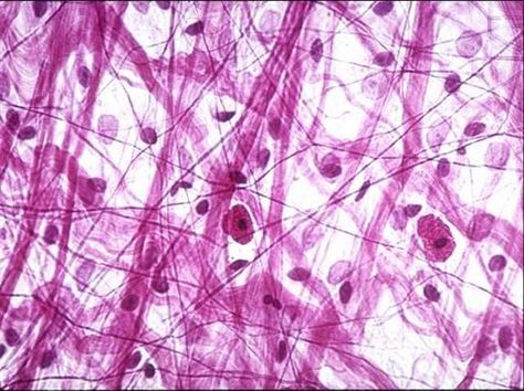 Areolar tissue (loose fibrous connective tissue) are characterized by lots of ground substance (more space, less fibers). It contains collagen and elastic fibers, fibroblasts, and numbers blood vessels. It can be found underlying almost all epithelia (providing nutrients from blood vessels to epithelia) , around blood vessels, esophagus, trachea, etc. It functions to loosely bind epithelia to other tissues, immune function, and allows passage for nerves/blood vessels. Areolar Connective Tissue, Serous Membrane, Loose Connective Tissue, Histology Slides, Types Of Bones, Skin Anatomy, Types Of Muscles, Cell Forms, Integumentary System