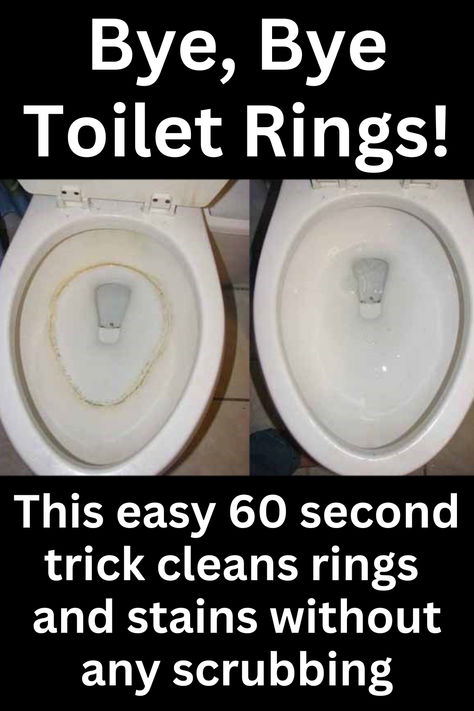 "Lazy Moms" toilet cleaning trick cleans the whole bowl in 60 seconds without any scrubbing at all. Cleaning Toilet Ring, Clean Toilet Bowl Stains, Toilet Cleaning Hacks, Toilet Ring, Easy House Cleaning, Toilet Stains, Diy Tips And Tricks, Clean Toilet Bowl, Easy Cleaning Hacks