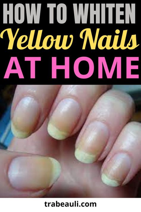 nail art How To Whiten Nails, Make Nails White, Stained Nails, Natural Nail Tips, Nail Remedies, Nail Whitening, Nail Care Diy, May Nails, Nail Care Routine