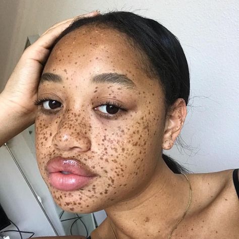 Freckles How To Get Freckles, Black Freckles, Koh Gen Do, Beauty Marks, Beautiful Freckles, Foxy Brown, Freckle Face, Japanese Skincare, Juicy Lips