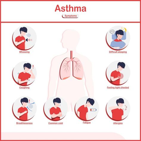 Vector illustrations infographic,symptoms of asthma.fatigue,wheezing,coughing,chest pain,common cold,breathlessness and difficult sleeping.flat style. Asthma Medication Chart, Cough Variant Asthma, Symptoms Of Asthma, Asthma Humor Meme, Asthma Symptoms, Common Cold, Chest Pain, Flat Style, Vector Illustrations