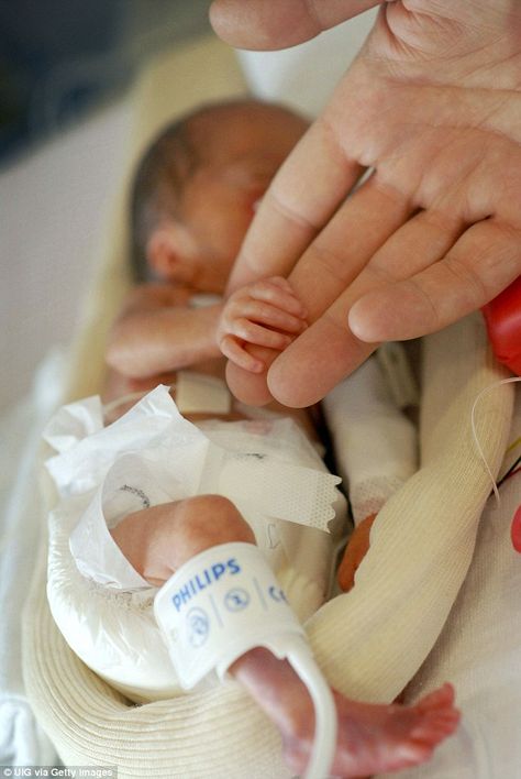 The hidden toll of being a premature baby: Modern medicine helped them defy the odds. But as the first generation of ultra-premature babies grow up, their struggles are far from over...  Read more: http://www.dailymail.co.uk/femail/article-3414833/Hidden-toll-premature-baby-Modern-medicine-helped-defy-odds-generation-ultra-premature-babies-grow-struggles-far-over. University Of California Davis, Healthy Baby Boy, Miracle Baby, Prenatal Care, Premature Baby, First Generation, Pregnancy Week By Week, Marriage And Family, Having A Baby