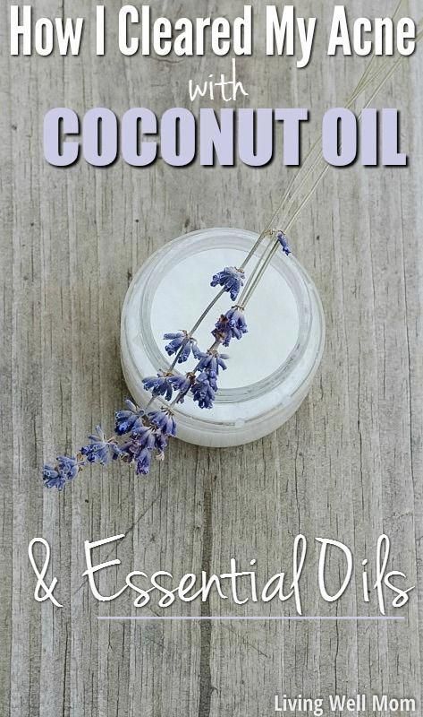 Coconut Oil And Essential Oils, Autogenic Training, Health Coconut Oil, Diy Coconut Oil, Coconut Oil For Acne, Coconut Oil Skin Care, Skin Care Routine For 20s, Coconut Oil Hair Mask, Coconut Oil For Face