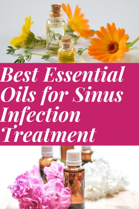 10 Best Essential Oils for Sinus Infection | Sirasclicks Young Living Sinus Infection, Sinus Infection Essential Oils, Essential Oils For Sinus Infection, Oils For Sinus Infection, Doterra Roller Bottle Recipes, Essential Oils Sinus, Sinus Infection Symptoms, Essential Oil Roller Bottle Recipes, Oils For Sinus