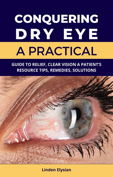 eyes aesthetic,  eye reference,  human eye,  eye anatomy Dry Eye Remedies, Dry Eyes Causes, Irritated Eye, Dry Eye, Eye Sight Improvement, Eyes Problems, Alternative Treatments, Light Eyes, Clear Vision