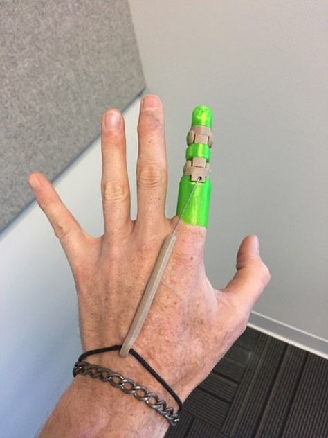 Knick's Prosthetic Finger v3.5.5 by knick - Thingiverse Prosthetic Fingers, Prosthetic Device, Prosthetic Limbs, Broken Finger, Useful 3d Prints, The Knick, Finger Tattoo For Women, 3d Printer Designs, 3d Printing Projects