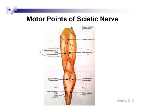 Sciatic Nerve, Leg Muscles, Sciatica, Nerve, Muscles, Health