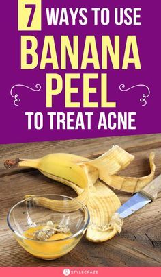 How To Use Banana Peel On Face, Banana Face Mask For Acne, Banana Peel Uses Skin, Face Mask For Wrinkles, Banana Peel Uses, Banana Facial, Grow Money, Acne Beauty, Skin Hacks