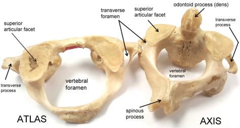 Atlas and Axis | Anatomy Corner Atlas And Axis Anatomy, Atlas Anatomy, Skeletal System Anatomy, Human Skeleton Anatomy, Anatomy Bones, Skeleton Anatomy, Basic Anatomy And Physiology, Cervical Vertebrae, Nursing Student Tips