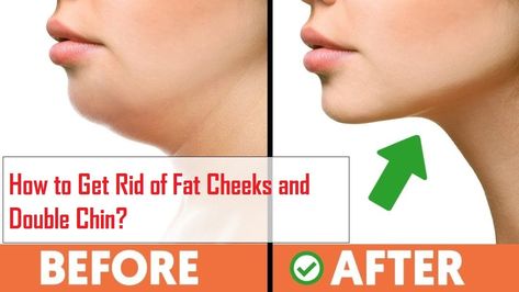 How to Get Rid of Fat Cheeks on Face and Double Chin Fast Fat Burning Workout, Rid Of Double Chin, Lose Love Handles, Neck Tightening, Health Chart, Facial Yoga, Cut Fat, Slimmer Face, Thigh Fat