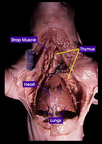 Thoracic Cavity Whitman College, How To Control Sugar, Thoracic Cavity, Lung Anatomy, Natural Decongestant, Iron Lung, When To Plant Vegetables, Normal Blood Sugar Level, Face Pores