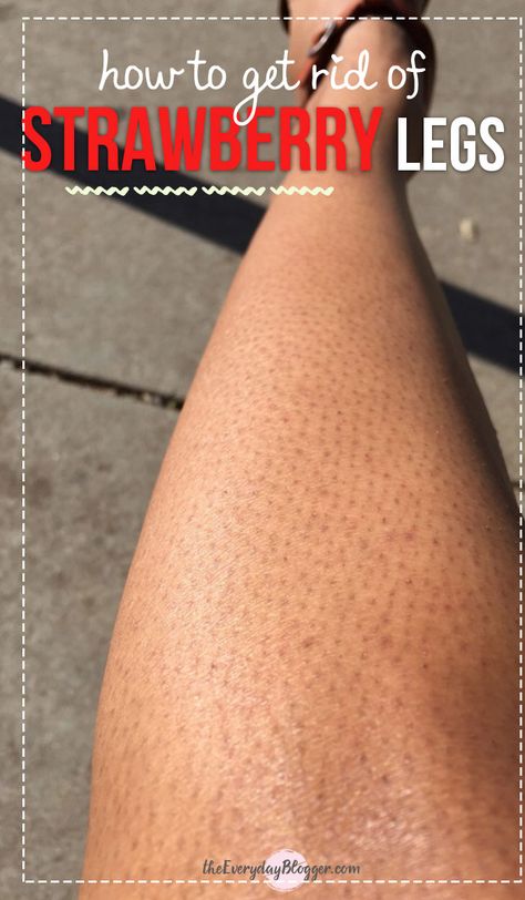 How to Get Rid of Strawberry Legs Yovanna Ventura, Strawberry Legs, Best Makeup Tutorials, Natural Beauty Tips, Lose 40 Pounds, Unwanted Hair, Face Scrub, Smooth Skin, Beauty Care