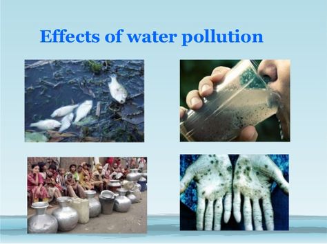 Water Pollution Facts, Effects Of Water Pollution, Water Facts, Contaminated Water, Clean Drinking Water, World Water Day, Water Day, Water Effect, Water Pollution