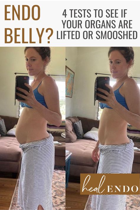 If you have a big endo belly lower belly pooch, check for core dysfunction! It may be a visual of your organs being pushed down thanks to poor core function. Learn how to lift them back up, rather than sucking in! #endometriosis #endobelly #endometriosisbloat #endodiet What Causes Lower Belly Pooch, Why Do I Have A Lower Belly Pooch, Endo Belly Diet, Supplements For Endo, Endo Belly Pictures, Dressing With A Belly Pooch, Core Dysfunction Exercises, Distended Abdomen Women, Gluten Belly Before And After