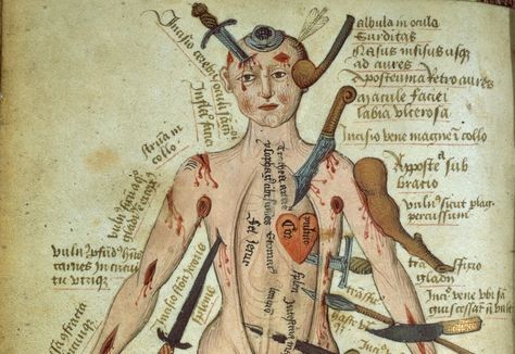 Medieval Images of the Human Body - Medievalists.net compare with  that zappy doctor game Medical Textbooks, Medieval Paintings, Late Middle Ages, Medieval Life, History Humor, Medieval History, Dark Ages, Medieval Art, Montpellier