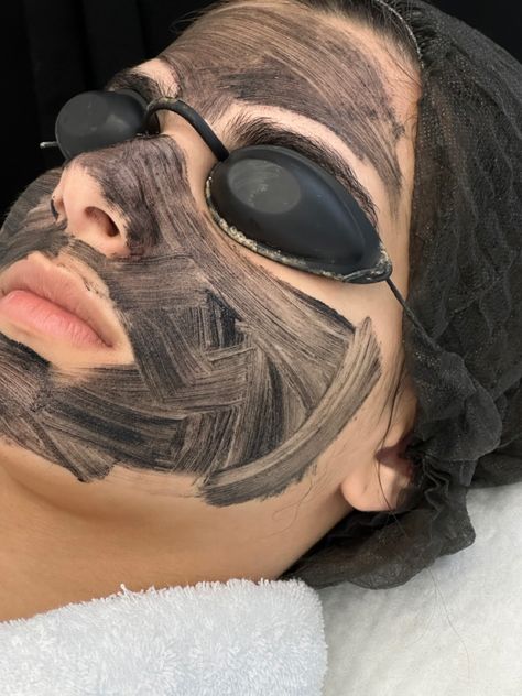 Carbon Peeling Laser, Hollywood Facial, Carbon Laser Facial, Hollywood Peel, Carbon Facial, Salon Marketing Social Media, Carbon Peel, Carbon Laser, Laser Peel