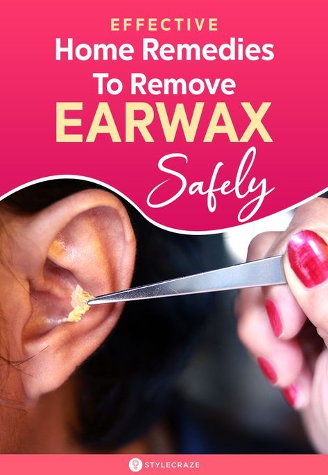 Natural Ear Wax Removal, Clean Ear Wax Out, Unclog Ears, Impacted Ear Wax, Earache Remedies, Ear Cleaning Wax, Clogged Ears, Ear Wax Buildup, Cleaning Your Ears