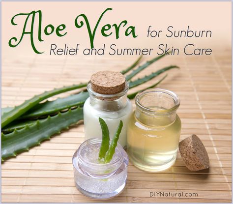 Aloe Vera for Natural Summer Skin Care Remedies For Sunburn, Home Remedies For Sunburn, Aloe Vera For Sunburn, Natural Remedies For Sunburn, Summer Skin Care, Sunburn Skin, Sunburn Remedies, Aloe Vera For Skin, Natural Acne Remedies