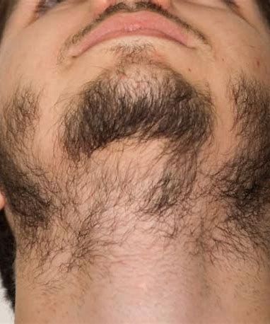 Tired of having a patchy beard? Learn how to fix and grow out bald spots in your beard with pro tips on styling, trimming, nutrition, and beard growth products. Facial Hair Growth For Men, Patchy Beard Styles For Men, How To Grow A Beard, Trimmed Beard Styles, Patchy Beard Styles, Bald Beard, Beard Growth Tips, Beard Maintenance, Growing Facial Hair