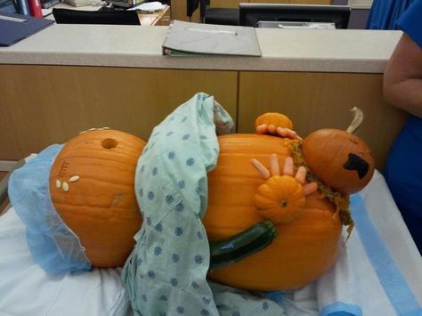 Ob/gyn pumpkin Funny Pumpkin Carvings, Pumpkin Decorating Contest, Halloween Jokes, Pumpkin Contest, Pregnant Halloween, Creative Pumpkins, Funny Pumpkins, Carving Ideas, Baby In Pumpkin