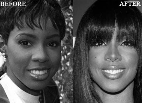 Kelly Rowland Nose Job Kelly Rowland Nose Job Before and After Photo Beyonce Nose Job, Nose Reshaping, Kelly Rowland, Nose Job, Destiny's Child, The Nose, Second Best, Cosmetic Surgery, Plastic Surgery