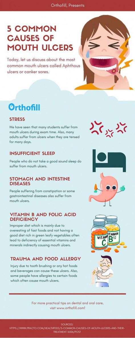 5 Common Causes of Mouth Ulcers. Dental Infographics to make you more aware of dental and oral problems. Visit www.Orthofill.com to learn more! #WhoDefinitionOfOralCare #HowToTakeCareOralHealth #WhatIsOralBGumCareMode #WhatDoesOralCareMeanToYou Mouth Ulcers Causes, Dental Infographics, Mouth Ulcer, Mouth Problems, Dental Images, Gastrointestinal Disease, Canker Sore, Oral Health Care, Tooth Decay