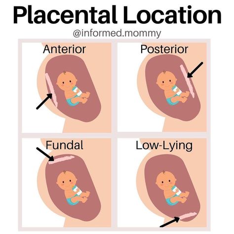 Photo shared by Liz | Prenatal Educator on April 25, 2021 tagging @informed.mommy. May be an image of text that says 'Placental Location @informed.mommy Anterior Posterior Fundal Low- ying'. Mother Baby Nursing School, Midwifery Quotes, Spiritual Midwifery, Anterior Placenta, Nursing School Studying Cheat Sheets, Obstetric Ultrasound, Medical Assistant Student, Midwifery Student, Placenta Encapsulation