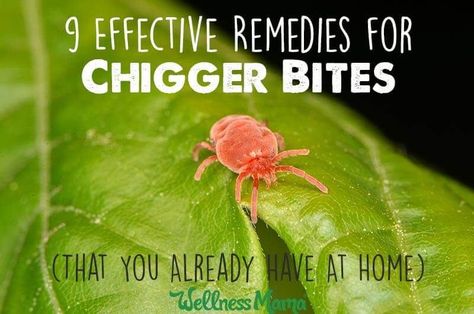 9 Effective Remedies for Chigger Bites (You Have at Home)  The itching from chigger bites is enough to drive anyone crazy. Try these effective remedies: baking soda, salt, diatomaceous earth and more. Chigger Bite Remedy, Bug Bites Remedies, Wellness Mama, Health And Fitness Articles, Bug Bites, Holistic Remedies, Diatomaceous Earth, Natural Health Remedies, Be Natural