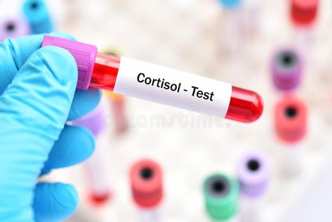 Blood for cortisol hormone test. Test tube with blood sample for cortisol hormon #Sponsored , #Affiliate, #sponsored, #hormone, #Blood, #sample, #test Cortisol Hormone, Test Image, Test Tube, Icons Design, Toothpaste, Design