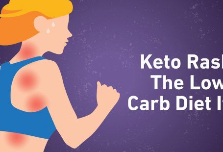 keto rash Keto Rash, Bad Carbohydrates, Carb Cycling Diet, High Carb Foods, Carbohydrates Food, Keto Diet Food List, Carbohydrate Diet, Low Carbohydrate Diet, Low Carb Keto Recipes