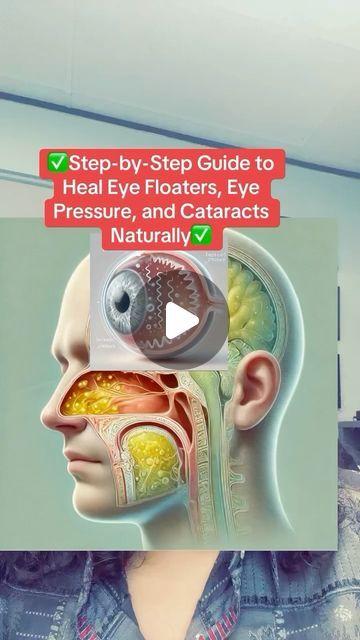 Raw (Mourab) Maraby on Instagram: "✅Step-by-Step Guide to Heal Eye Floaters, Eye Pressure, and Cataracts Naturally✅#EyeHealth #EyeFloaters #EyePressure #SinusCongestion #NaturalRemedies #VisionSupport" Eye Pressure, Eye Floaters, Sinus Congestion, Eye Health, Health Remedies, Eye Care, Herbal Remedies, Step Guide, Home Remedies