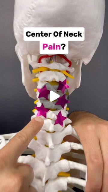 Dr. Joe Damiani - TMJ, Head & Neck Specialist on Instagram: "Comment the word ‘NECK’ on this post if you need help getting rid of Neck Pain for good.

Do you experience neck pain that persists on the center of the neck? This can happen if you are unable to maintain your cervical spine in an upright position.

One key muscle group that pulls the neck into an upright posture are the Deep Neck Flexors!  They attach to the FRONT of the cervical vertebrae (AKA Neck) and facilitate stabilization.

In this video I show a test that can determine if these muscles are weak on you.  If the test is positive AKA the muscles are weak.  I have also included an exercise to begin building strength.  Test yourself and start getting stronger!

#neckpain #neckpainrelief #neckpaintreatment #pinchednerve #cervi Knots In Neck Muscle, Neck Decompression, Cervical Pain Exercises, Neck Muscle Anatomy, Upright Posture, Muscles Of The Neck, Cervical Pain, Neck Muscles, Cervical Vertebrae