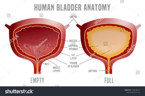 Full and empty Urinary bladder. Human organ anatomy. Editable vector illustration in realistic style isolated on white background. Medical, healthcare and scientific concept. Educational infographic #Ad , #affiliate, #anatomy#organ#Editable#illustration Organ Anatomy, Urinary Bladder, Background Medical, Human Organ, Educational Infographic, Anatomy, Alcoholic Drinks, Health Care, White Background