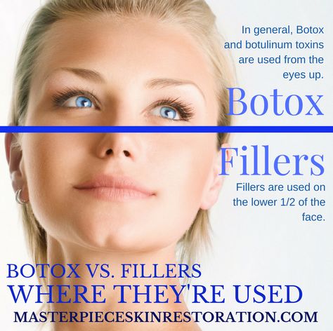 Botox vs. Fillers | Which Will Work Best for YOU? [Free Infographic] | They sound scary when you're new to medical skincare. Our post will help you find the best one for you! #Botox #Fillers #whatdofillersdo #whatdoesBotoxdo #MasterpieceSkinRestoration #hyaluronicacid Botox Vs Fillers, Botox Cost, Medical Skincare, Restylane Lyft, Antiaging Skincare, The Best Skin Care Products, Minimize Wrinkles, Pinterest Manager, Anti Aging Secrets