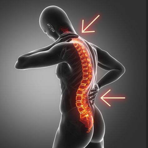 Types of Spine Curvature Disorders - Spine Institute of Arizona Lumbar Lordosis, Body Aches, Marketing Words, Spine Surgery, Body Ache, Poor Posture, Medical Knowledge, Natural Curves, Chandigarh