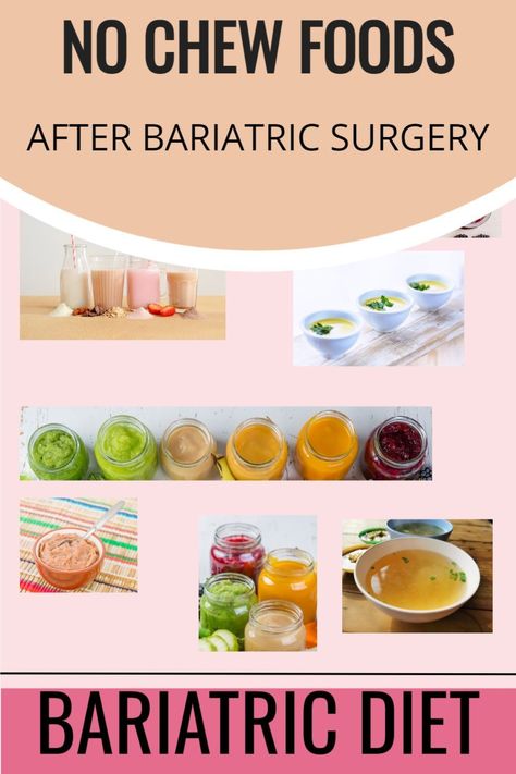 No Chew Foods After Surgery Bariatric. Bariatric Meals & Bariatric Lunch Ideas. Pureed Diet No Chew Foods, No Chew Foods After Surgery, Bariatric Lunch Ideas, Bariatric Lunch, Pureed Diet, Bariatric Meals, Bariatric Diet, Soft Foods, Popular Christmas Gifts