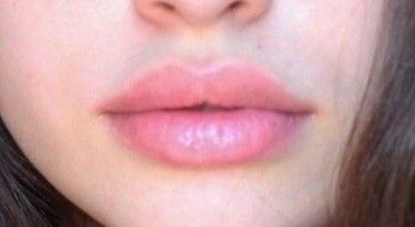 Lips Aesthetic, Lips Inspiration, Angel Makeup, Ethereal Makeup, Girl Thinking, Lip Shapes, Full Lips, Lip Injections, Perfect Lips