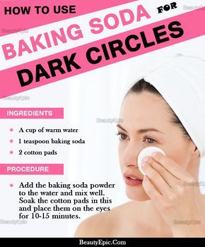 Baggy Eyes, Skin Care Routine For 20s, Remove Dark Circles, Under Eyes, Dark Circles Under Eyes, Dark Circle, Natural Treatments, Eye Care, Dark Circles