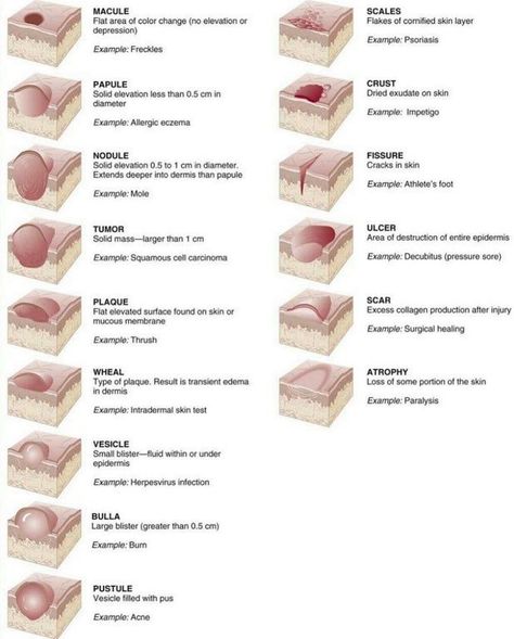 Types of Skin Lesions Charting For Nurses, Skin Lesions, Doctor Quotes Medical, Skin Anatomy, Esthetician School, Medical Mnemonics, Human Body Organs, Integumentary System, Vet Medicine