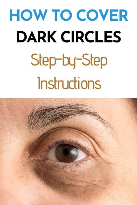 Under Eye Dark Circles Over 50, Diy Dark Under Eye Circles, Dark Circles Cover Up Make Up, What To Do For Dark Circles Under Eyes, Best Makeup For Dark Circles Under Eyes, Dark Undereye Circles Remedies, Best Way To Cover Dark Under Eye Circles, How To Correct Dark Circles Under Eyes, Make Up For Dark Circles Under Eyes