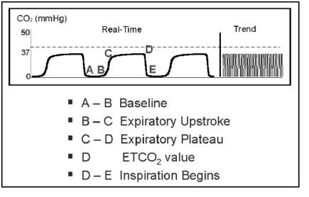 Capnography Monitoring Anesthesia School, Paramedic School, Nursing Cheat, Brain Book, Medical Tech, Mechanical Ventilation, Emt Paramedic, Emergency Medical Technician, Vet School