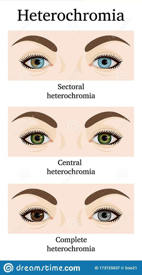 Sectoral Heterochromia, Central Heterochromia, Heterochromia Eyes, How To Draw Eyelashes, Hazel Green Eyes, Novel Characters, Work Nails, Aesthetic Eyes, Eye Design