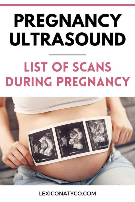 Are you pregnant and wondering how many ultrasounds you will have over the next nine months? Here’s a complete breakdown of a typical pregnancy ultrasound schedule. This post will cover… More Pregnancy Symptoms By Week, 2nd Trimester Pregnancy, Trimester To Do List, 3rd Trimester Pregnancy, Pregnancy Constipation, Second Trimester Pregnancy, Pregnancy Test Results, Test Pregnancy, First Trimester Tips