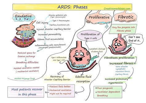 Paramedic Study, Acute Respiratory Distress, Respiratory Therapy Student, Nursing Major, Respiratory Distress, Nursing Instructor, General Medicine, Arterial Blood Gas, Nurse Study