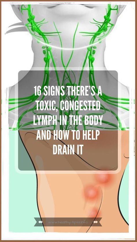 16 Signs There�s A Toxic, Congested Lymph In The Body And How To Help Drain It Cramps Relief, Health Planner, Creating A Newsletter, Health Remedies, Body Skin, Easy Workouts, Body Skin Care, Hair Removal, The Body