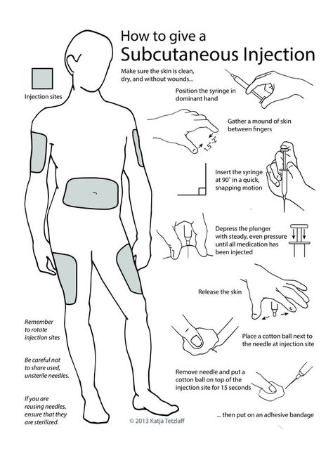 Subcutaneous Injection Sites, Injections Nursing, Insulin Injection Sites, Insulin Injection, Injection Sites, Subcutaneous Injection, Insulin Therapy, Medical Laboratory Science, Nursing Books